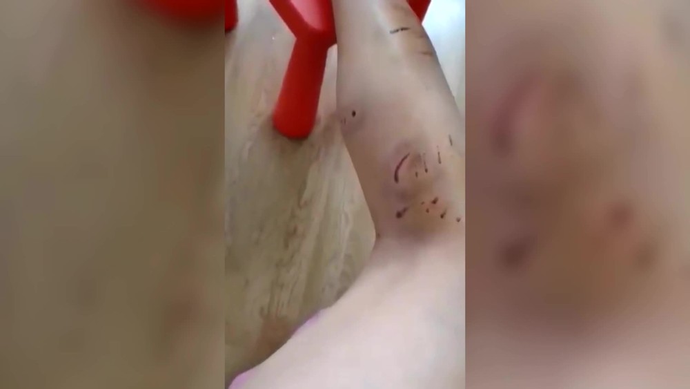 [multi] Dohryzena zena 11243