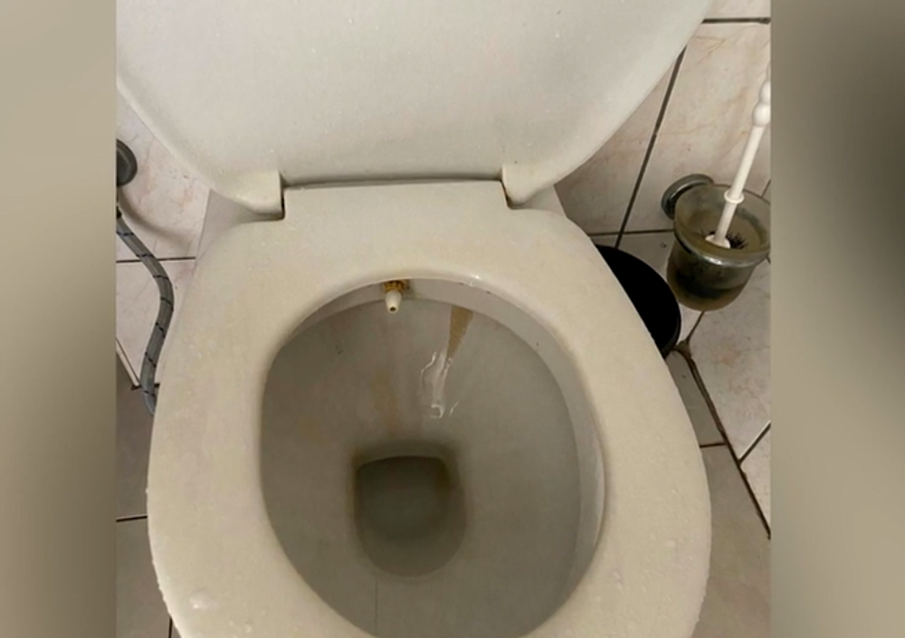 Turisti sa chcú súdiť s cestovnou kanceláriou. Bývali v špinavých a plesnivých hoteloch