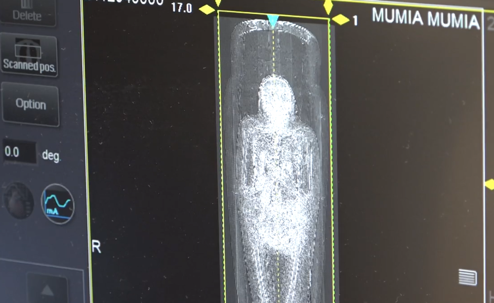 CT múmie 3