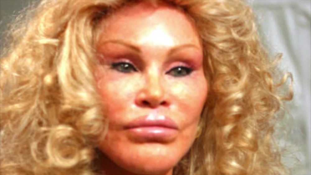 Jocelyn Wildenstein8593