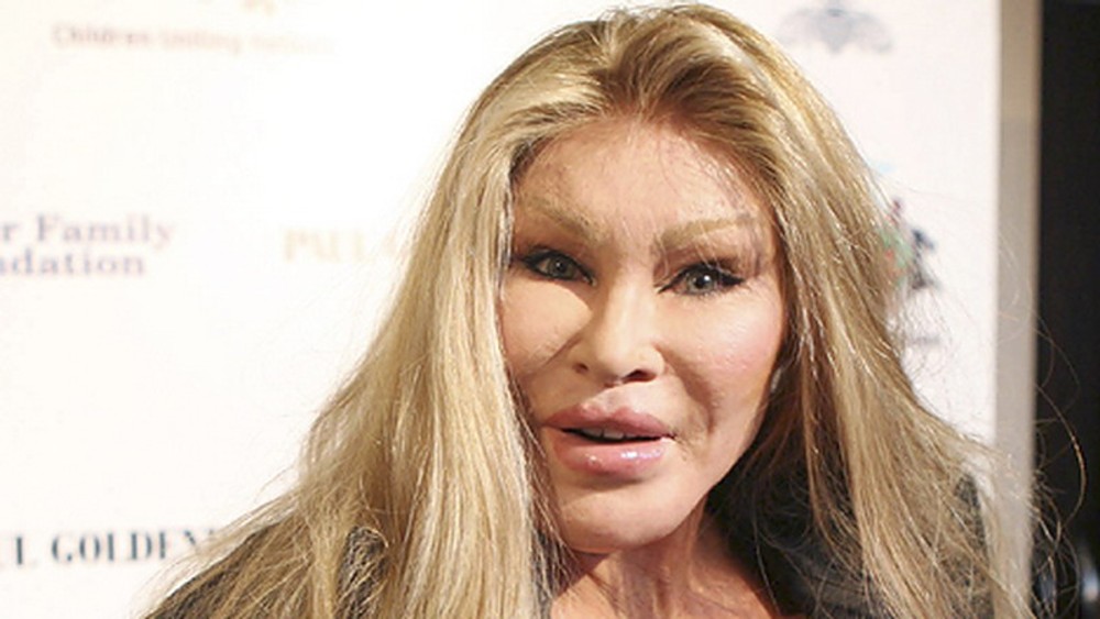 Jocelyn Wildenstein – „Nevesta Frankensteina“