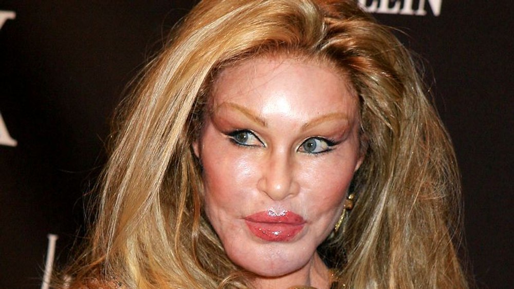 Jocelyn Wildenstein