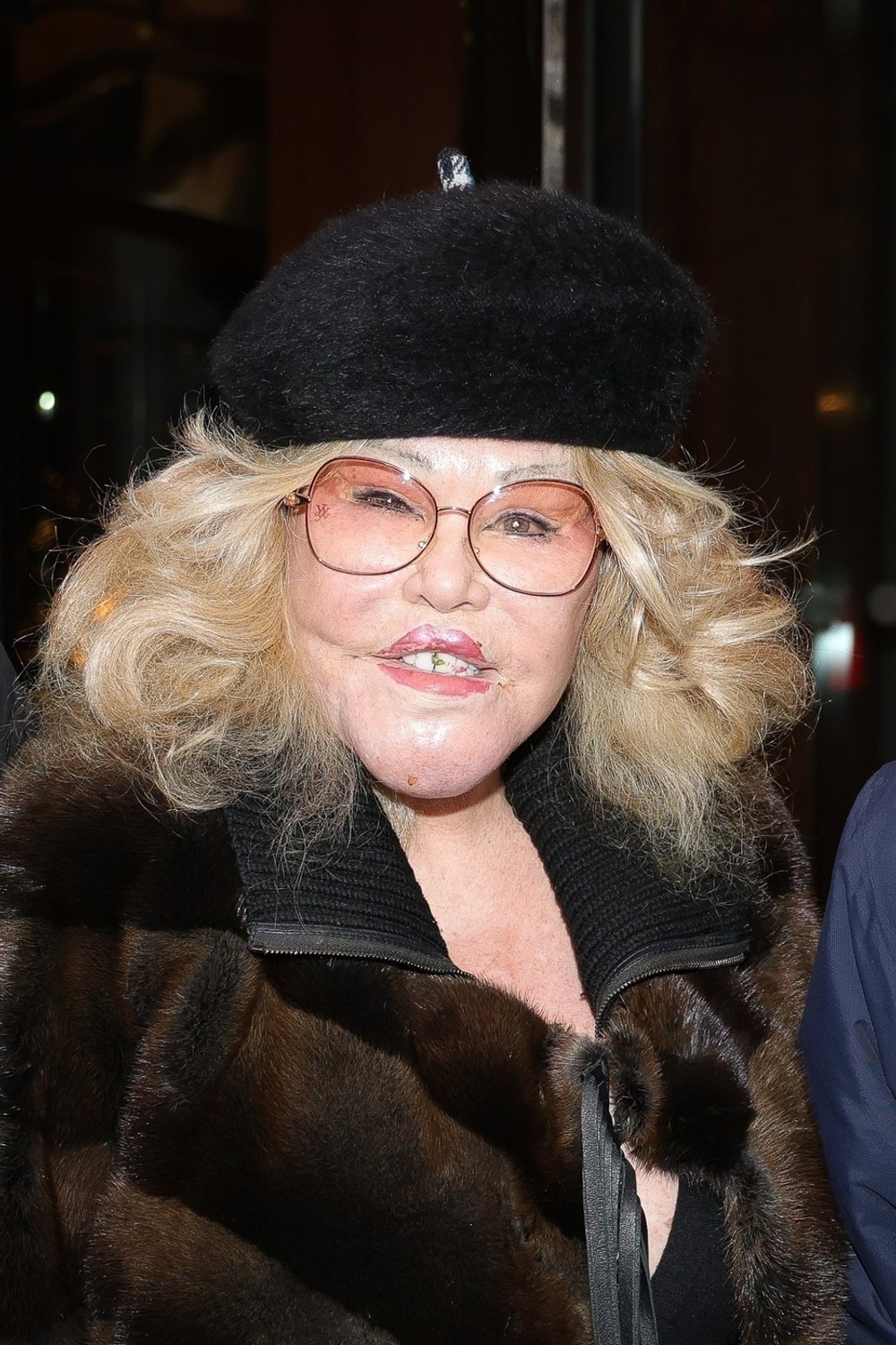 jocelyn wildenstein