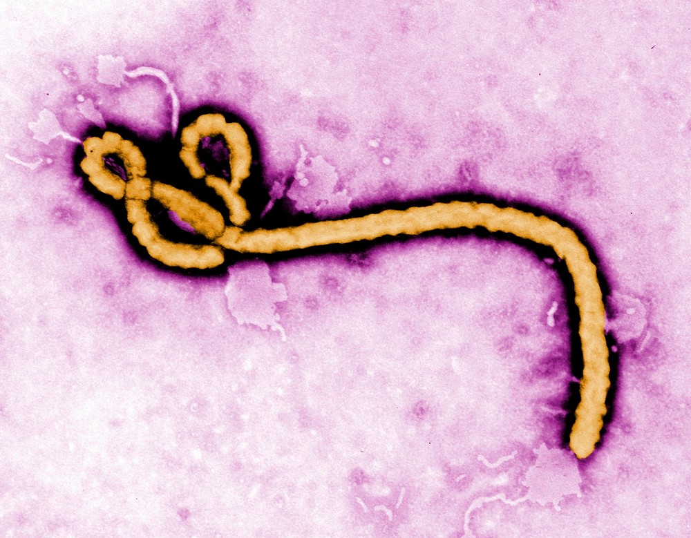 Nová epidémia eboly