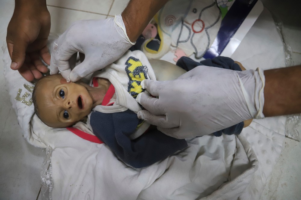 Hladomor v Pásme Gazy