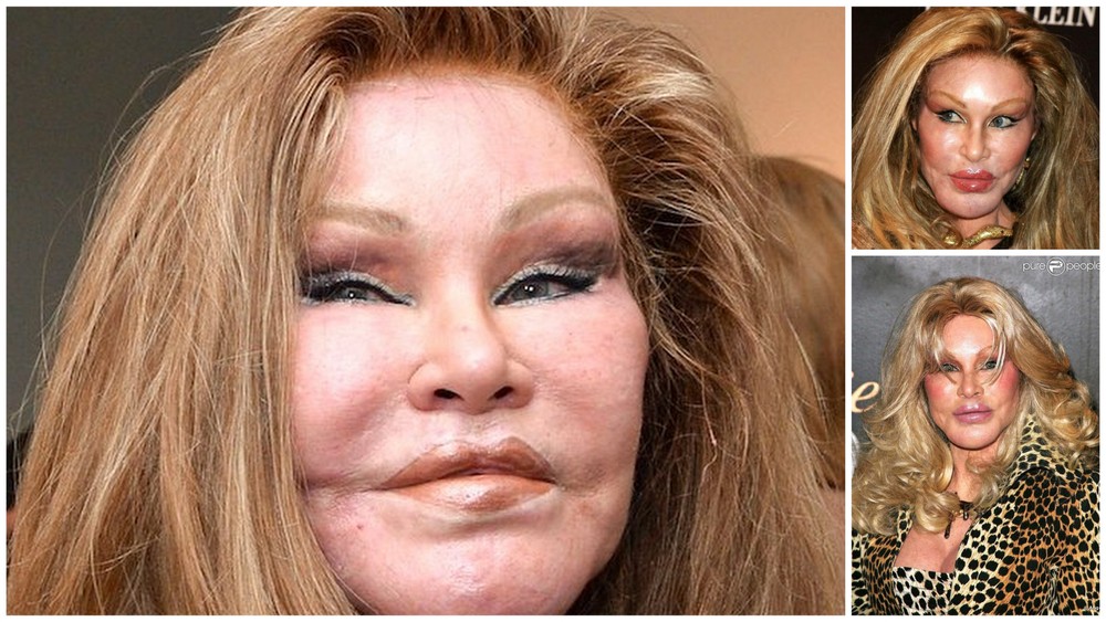 Jocelyn Wildenstein