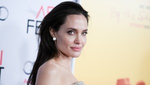 Slovenky podstupujú rovnakú operáciu ako Angelina Jolie