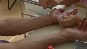 Alergikov potrápi najmä palina a ambrózia. Lekárov je ale v niektorých okresoch žalostne málo