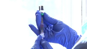 Hlavný hygienik upozorňuje rodičov: Slovensko zažíva epidémiu osýpok, aká tu roky nebola