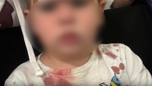 Po zrušení chirurgickej pohotovosti prežili rodičia s malým Markom nočnú moru