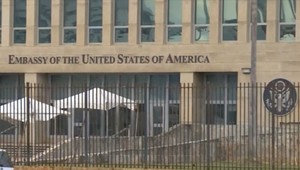 Americkí a kanadskí diplomati pôsobiaci na Kube majú potvrdené trvalé zmeny na mozgu