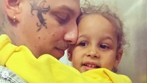 Dcérka Tiny a Separa vyzerá ako po poriadnej bitke! Pravda o podliatinách je TAKÁTO