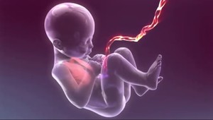 Pupočníková krv. Môže zachrániť vaše dieťa!