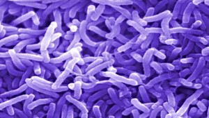 Nebezpečná cholera opäť straší. Zaručené tipy, ako sa chrániť...