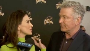 Hilaria Baldwin sa priznala: TOTO si 7-násobná mama nechala vylepšiť!