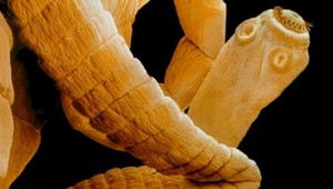 V ľudskom tele prežívajú škodlivé parazity, mnohí o tom ani netušia