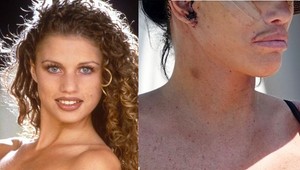 6 faceliftingov a 17 operácií prsníkov: Modelka šokovala tvárou