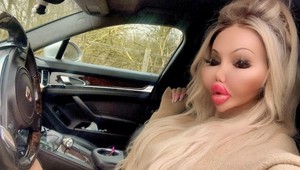 Žena "vďaka" plastikám nepripomína ČLOVEKA!