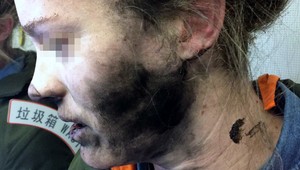 Žene na hlave explodovali slúchadlá