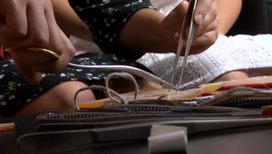 Ako udržať medikov na Slovensku? Mnohí by chceli ostať, názor sa však časom mení