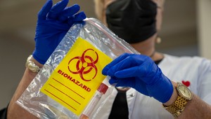 Rýchlo sa šíriaci vírus má ďalšie obete. Na toto ochorenie neexistuje vakcína