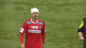 To sú babráci! Zápas sa ešte ani nezačal a už sa zranili dvaja hráči