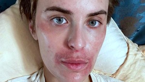 Dcéra hviezdneho páru ukázala neuveriteľnú premenu pokožky - cíti sa ako bohyňa!