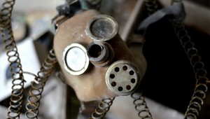 CT prístroj ožiari viac ako Černobyľ, hovorí odborník