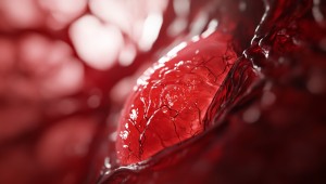 Nebezpečná výduť: Aké príznaky vás upozornia na aneuryzmu v rôznych častiach tela?