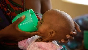 OSN varuje. Viac ako miliónu ľudí hrozí vyhladovanie