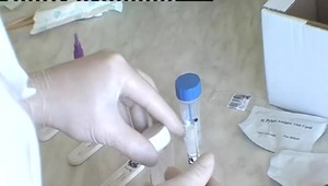 Dobrá správa: Umelá inteligencia môže poraziť baktérie odolné voči antibiotikám