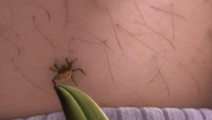 10 infekcií, ktoré nie sú nákazlivé: Ako ich môžete chytiť?