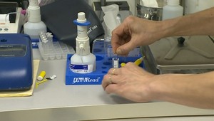 Dospelí, nezabúdajte na očkovanie! Nemusí sa to vyplatiť