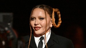 Najväčší šok na Grammy? Rozhodne tvár MADONNY, fanúšikovia sú zdesení!