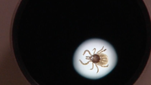 Máte čudné chrípkové príznaky? Možno máte lymskú boreliózu