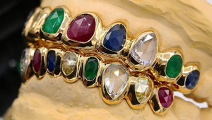 Najdrahší chrup sveta? Spevák si dal spraviť na zuby skutočne jedinečný šperk!