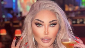 Bacuľatý chlapček! TAKTO vyzeral "Ken" Alves pred premenou na plastikovú Jessicu!