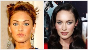 Hollywoodske lži: Tieto celebrity vyzerali pred plastikami celkom inak!