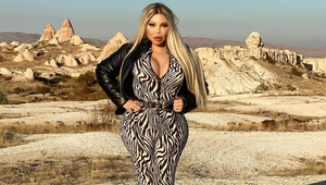 Monštrum?! Tak označil živú Barbie istý plastický chirurg, TOTO nasledovalo!