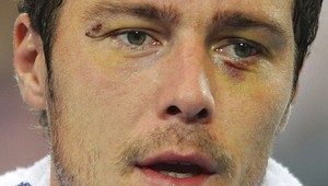 Safin:"Hrbatý ma unavuje!"