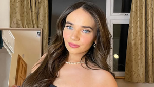 Dovolenka v Taliansku jej zničila život: Miesto nosa má teraz na tvári TOTO!