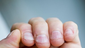 14 zlozvykov, ktoré poškodzujú vaše zdravie. Dokážete sa ich zbaviť?