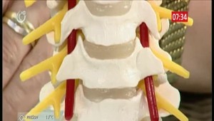 Nová liečba poranení miechy: Lekári i pacienti hlásia zlepšenie stavu hneď po zranení, ale aj po rokoch