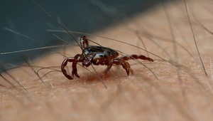 Úrady zaznamenali prvé prípady nakazenia kliešťovej encefalitídy. Pôvod nákazy vás zarazí