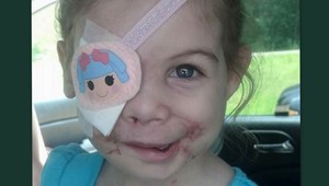 Dievča dohryzené pitbulmi vyhodili z reštaurácie, KFC mu zaplatí 30 tisíc