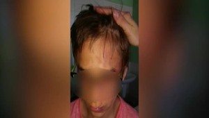 Prísne rodičovstvo môže pevne zakomponovať riziko depresie do DNA dieťaťa, tvrdí štúdia