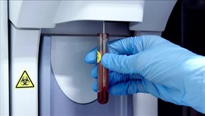 Antidopingoví komisári najviac kontrolovali Sagana a Kuzminovú. Pridali sa ale aj ďalšie mená