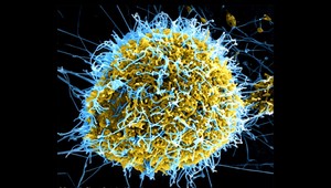 Nová vakcína proti ebole nebude vyžadovať ihlu. Môže ju podať ktokoľvek