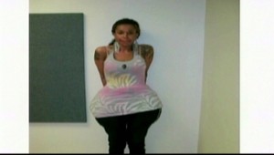 Falošný lekár zohavil dievča. Zadok jej napichal chemikáliami!