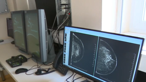 K dispozícii máme 3 bezplatné skríningy, no využíva ich menej než polovica obyvateľstva